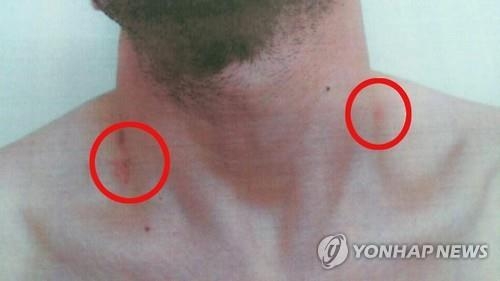'인권사각' 청주 외국인 보호소, 가스총 협박에 폭행(종합) - 2