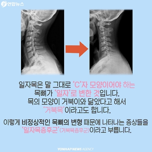 <카드뉴스> 목·어깨가 뻐근한 당신, '그냥 넘기면 안돼요!' - 3