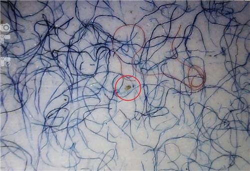 사건 관계자 의복에서 채취한 증거물을 현미경으로 확인한 결과 발견된 미세한 페인트 흔적(붉은 원)