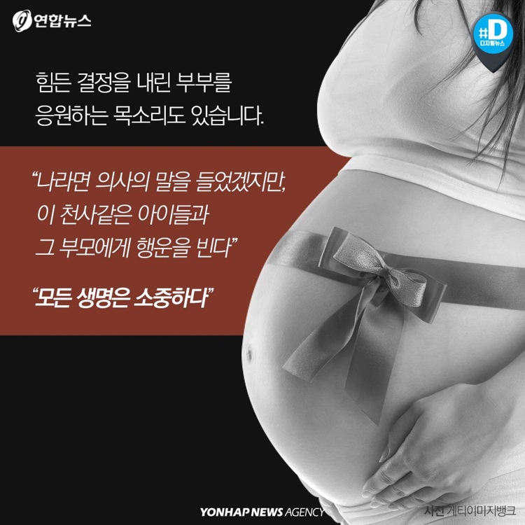 [카드뉴스] 샴쌍둥이 출산 고집한 부모…이기적인 것일까요 - 6