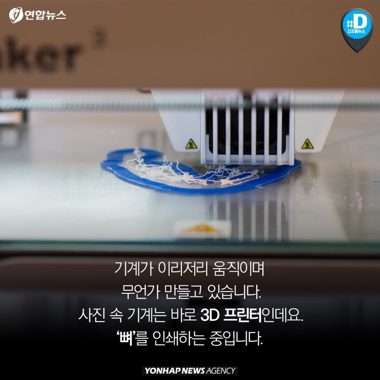 [카드뉴스] 혈관·뼈·내장 3D 프린팅 시대…장기이식 혁명 오나 - 2