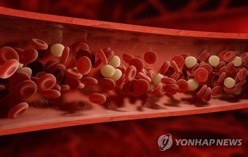 동맥혈관