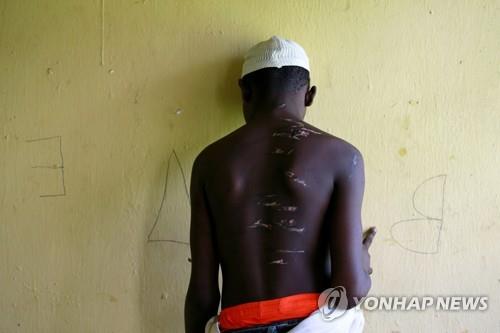 나이지리아 북부 교정시설에서 구출된 15세 소년