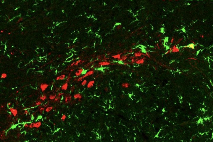 노화 도파민 뉴런(홍색)은 염증을 일으켜 소교세포(녹색)의 공격을 받는다.