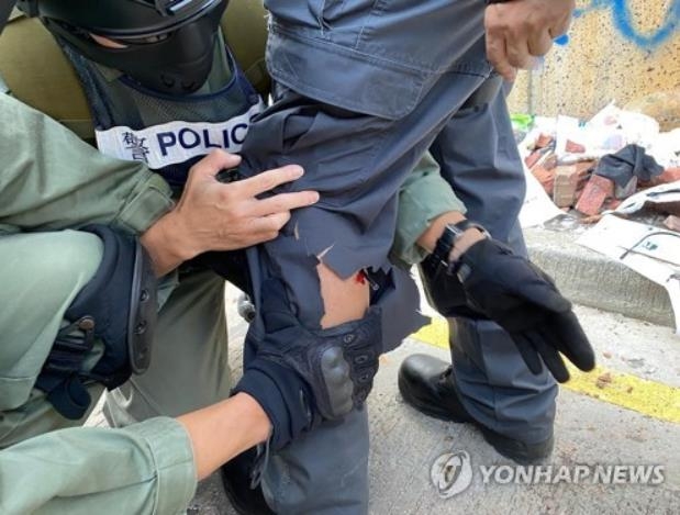 시위대가 쏜 화살에 다리를 맞은 홍콩 경찰