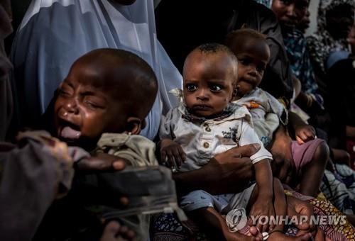 나이지리아 유니세프 보건소에서 어린이가 불안한 눈빛으로 검진 순서를 기다리고 있다. [유니세프 제공=연합뉴스]