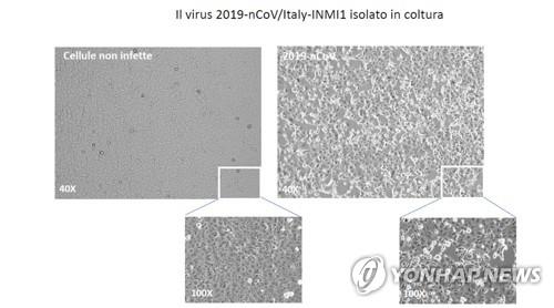 이탈리아 국립전염병연구소(INMI)가 신종 코로나바이러스를 분리했다며 공개한 사진