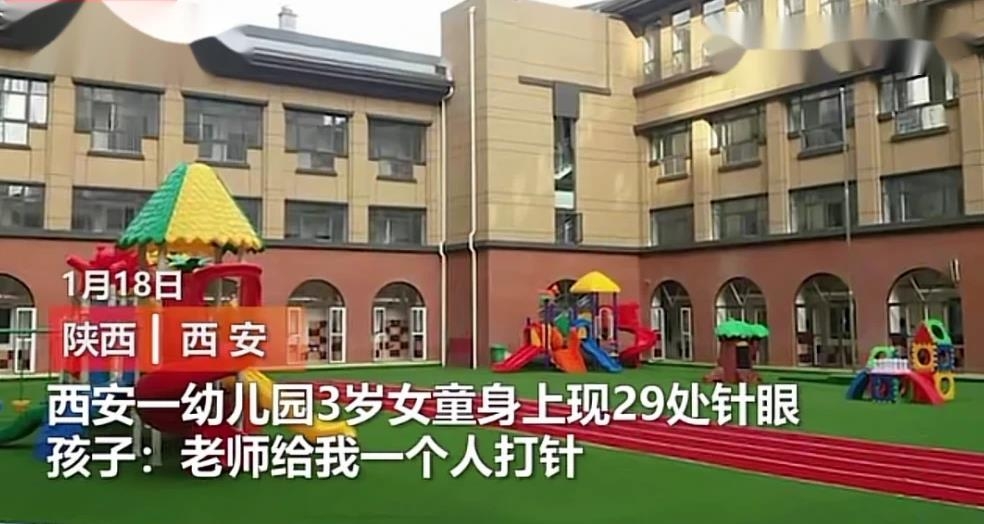 '바늘 자국이 29개라니' 중국 유치원서 여아 학대 논란