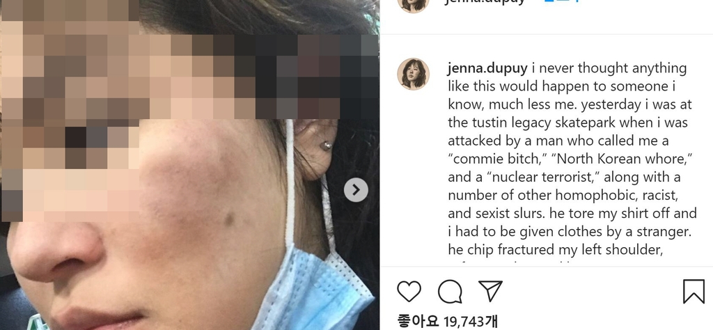 증오범죄 피해를 본 한국계 여성