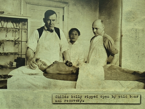 광주 나병원에서 복부 다친 아이 치료하는 윌슨 원장(1916)