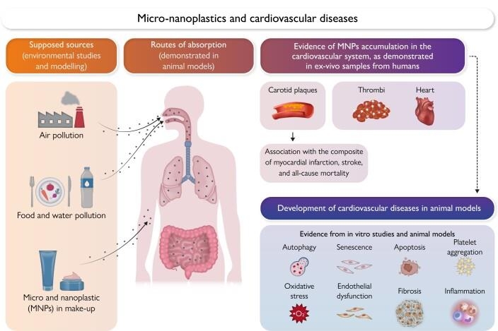 미세플라스틱의 심혈관질환 유발 모식도