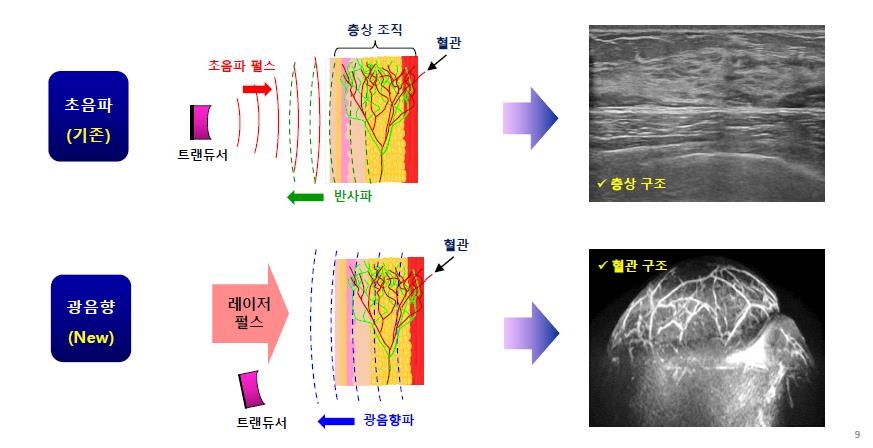 기존 초음파 내시경과 광음향 초음파 내시경 영상의 차이