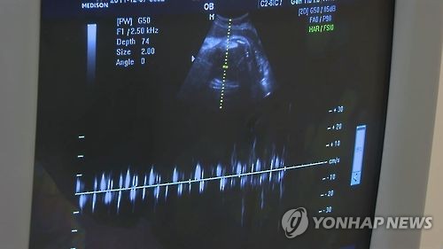 임신 초음파 검사