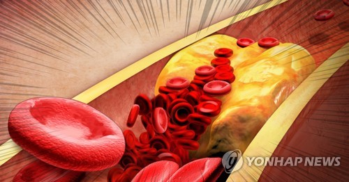 콜레스테롤 쌓인 혈관 (PG)