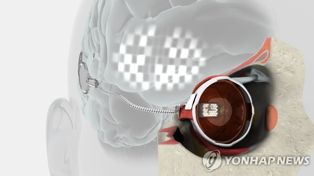 2012년 호주 연구진이 제작한 인공눈 시제품 관련 그래픽 자료.