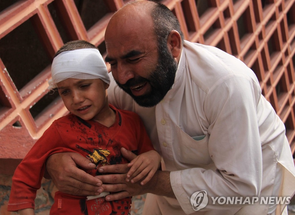 18일 아프간 잘랄라바드에서 벌어진 자폭테러로 다친 한 소년을 할아버지가 안고 있다.(EPA=연합뉴스)