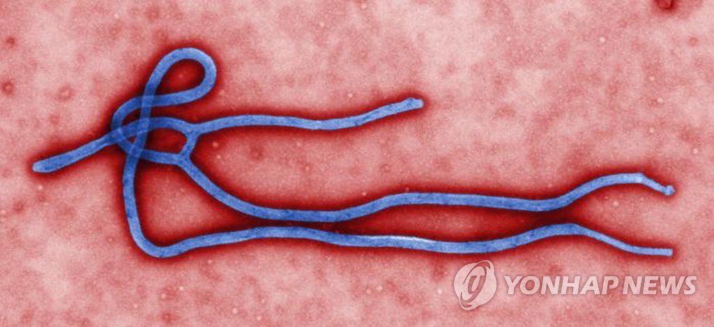 미국국립질병통제센터(CDC)가 제공한 에볼라 바이러스의 모습. (AP=연합뉴스 자료사진) 