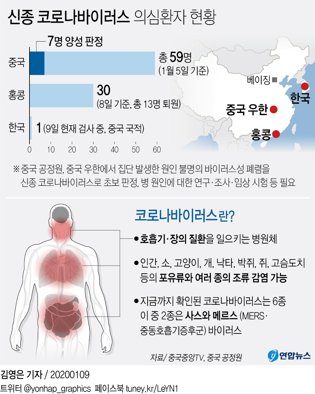 중국서 '우한 폐렴' 첫 사망자 발생…60대 남성 | 연합뉴스