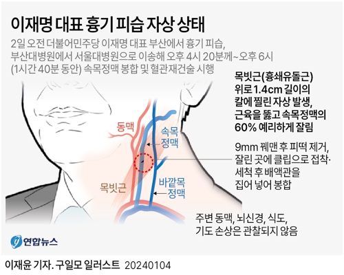 [그래픽] 이재명 대표 흉기 피습 자상 상태