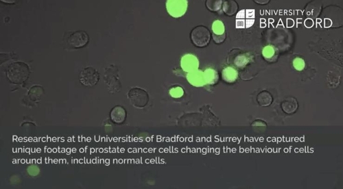 전립선암세포에서 배출된 EN2 단백질(녹색)