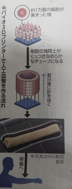 (도쿄=연합뉴스) 일본 사가(佐賀)대 연구팀이 추진 중인 '바이오 3D 프린터'를 이용한 인공혈관 제작 및 이식 흐름도. [요미우리신문 지면 촬영] 