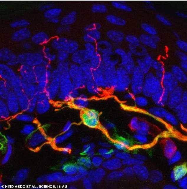 '통각성 신경교세포 복합체'(초록색)