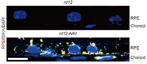 치료 전 생쥐(위)와 치료 후 생쥐(아래)를 비교했을 때 망막색소상피세포 내에 정상 단백질이 합성된 것을 확인할 수 있다. [서울대병원 제공]