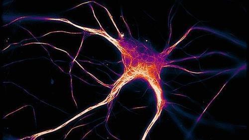 뉴런에 침적한 변형 타우 단백질