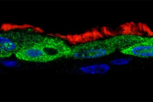 respiratory tract infected with RS virus