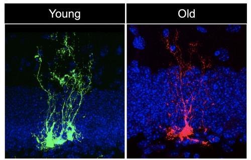 어린 생쥐와 늙은 생쥐의 신경줄기세포