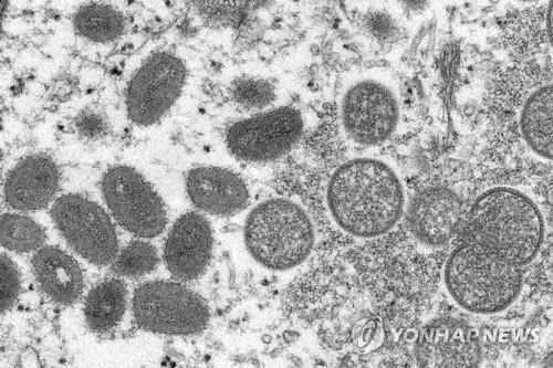 인도서도 원숭이두창 첫 사망자 발생…"UAE서 입국 20대 남성"