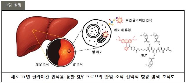 구분 어려운 암세포도 선명하게…한중 연구팀, 공동 기술…