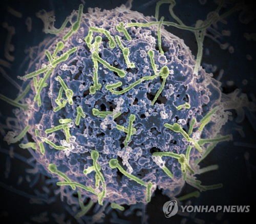 우간다 에볼라 바이러스 발병…24세 남성 사망