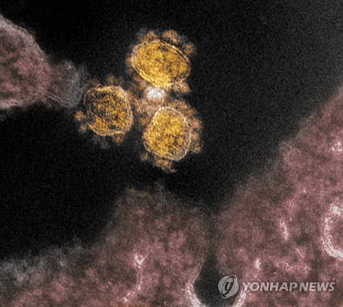 신종 코로나바이러스 전자현미경 이미지