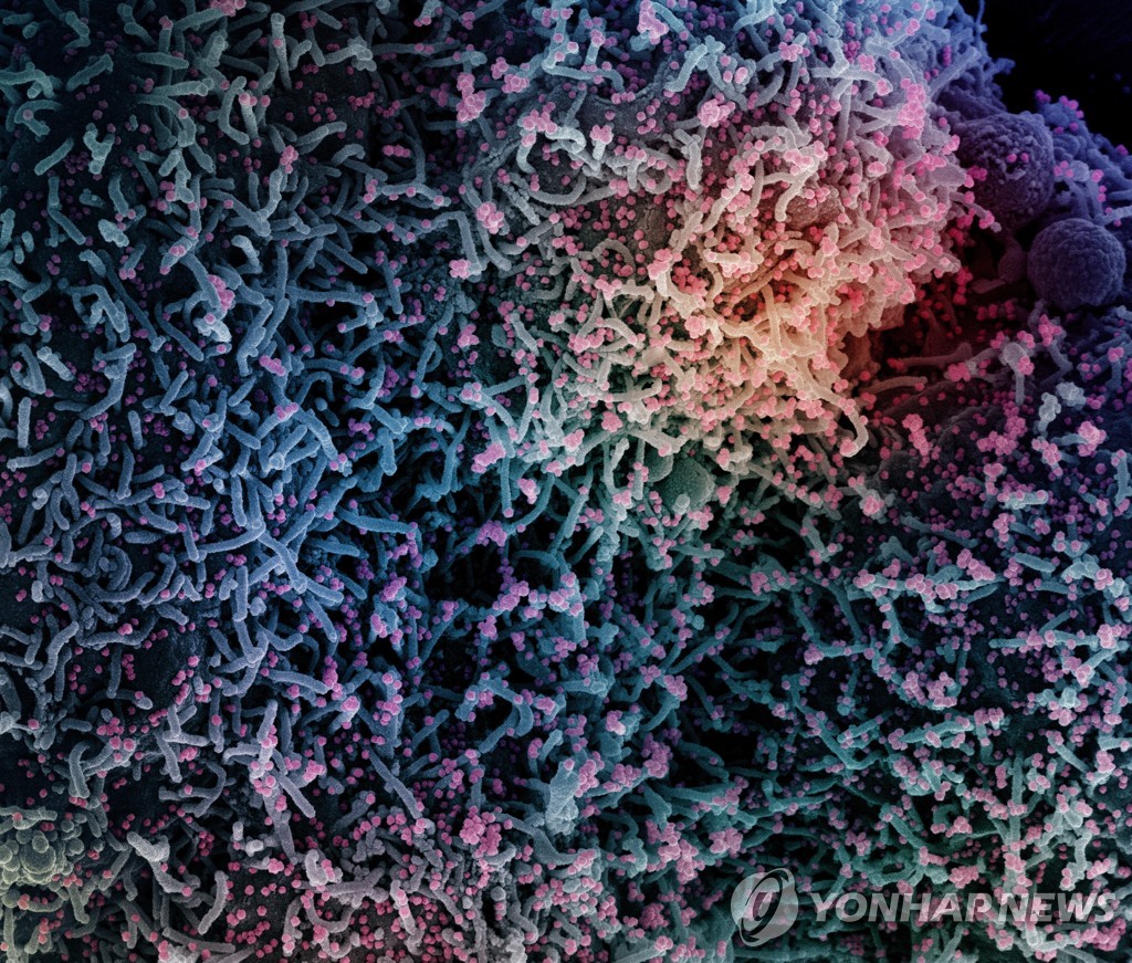 코로나 감염 세포의 전자현미경 사진