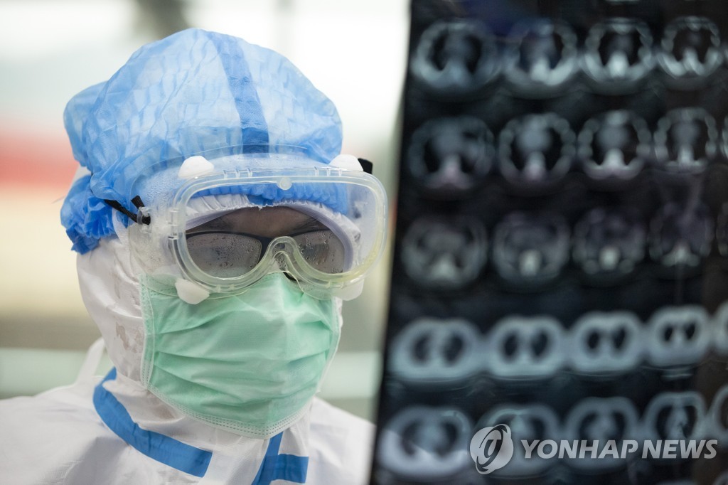 우한에서 의사가 환자의 CT 이미지를 확인하고 있다. [신화=연합뉴스 자료사진]